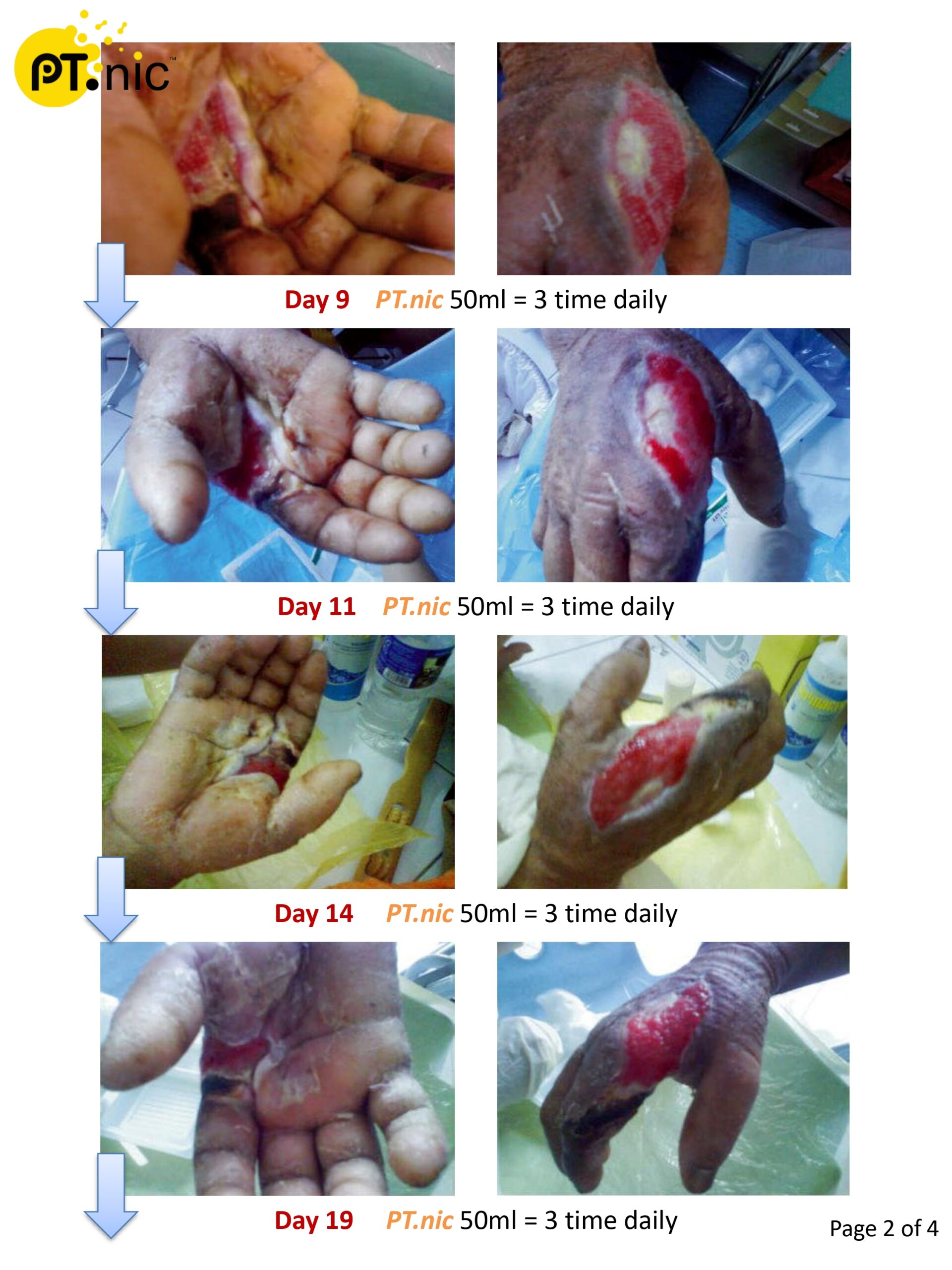 Diabetes Hand Case_page-0002