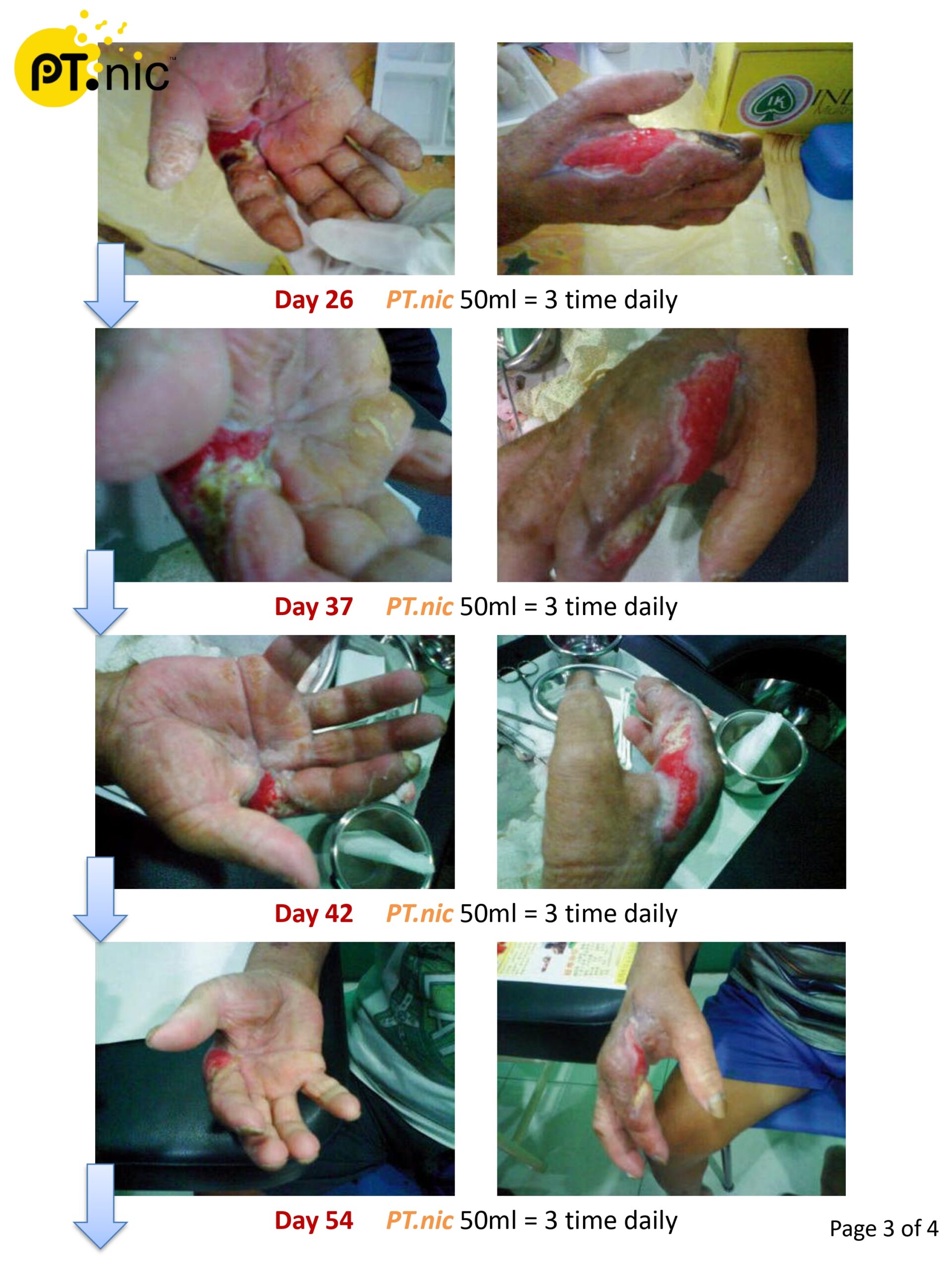 Diabetes Hand Case_page-0003