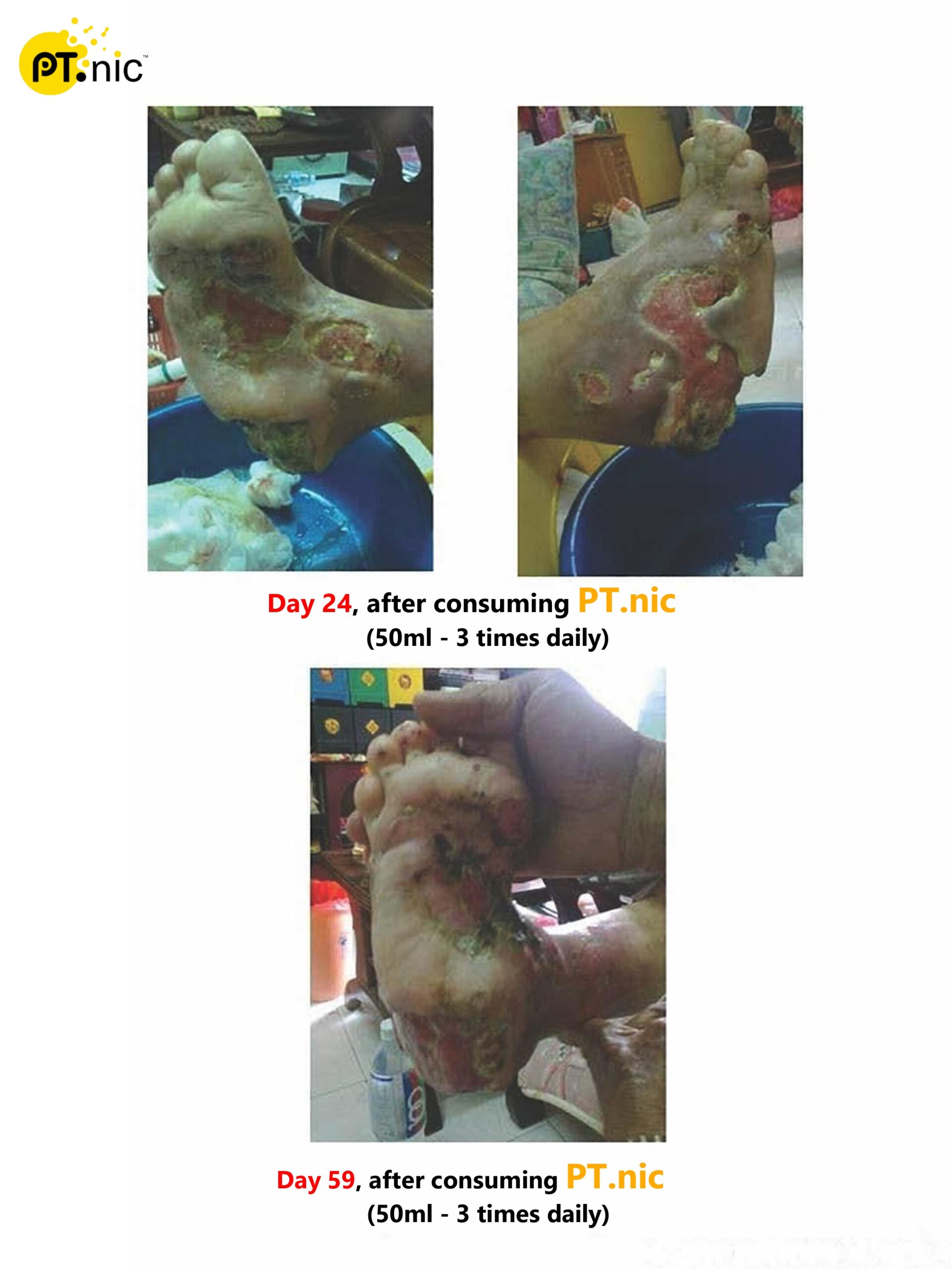 Diabetes Leg Case_page-0002